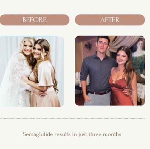 IV Therapy in Miami I Live Well IV